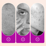 🌸 Makelloser Concealer für die Augenpartie｜Hellt dunkle Augenringe und Fältchen auf – Gratis-Finish