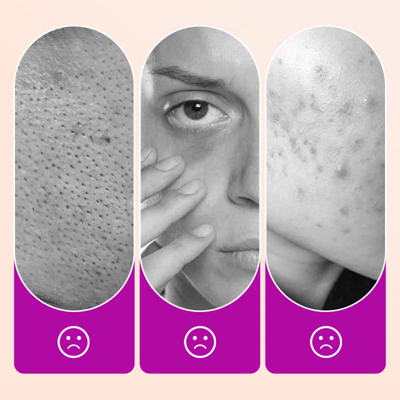 🌸 Makelloser Concealer für die Augenpartie｜Hellt dunkle Augenringe und Fältchen auf – Gratis-Finish