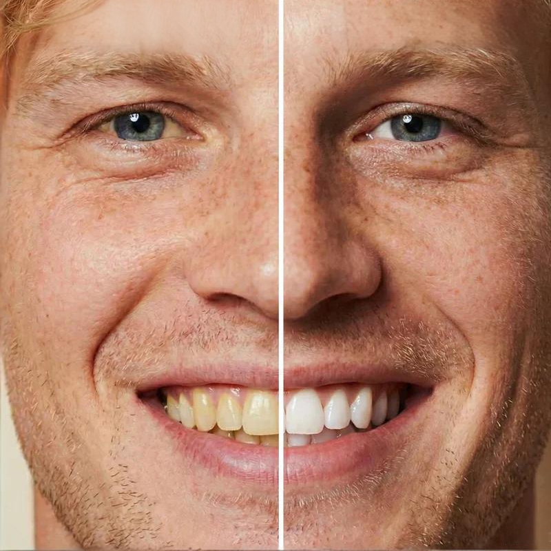 🏆 Neuheiten 2026 - 50 % Rabatt! 🧴 5 ml Sofort-Aufhellende Zahnfarbe😁🦷